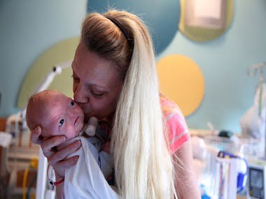 This Alabama baby born without a nose is adorable
