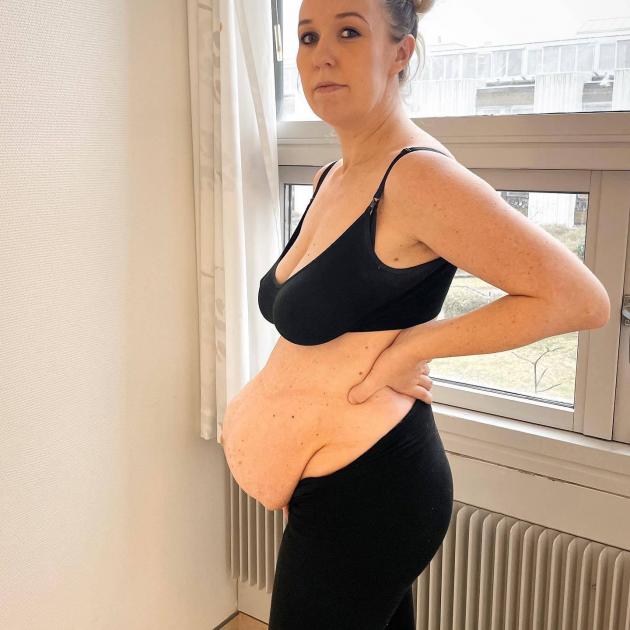 Michella also shared a photo of her postpartum stomach. Photo: Instagram/@filippaophelia